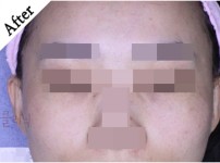 After