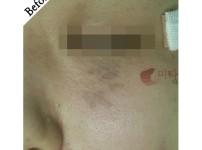 Before