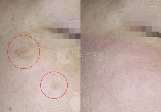 전후사진